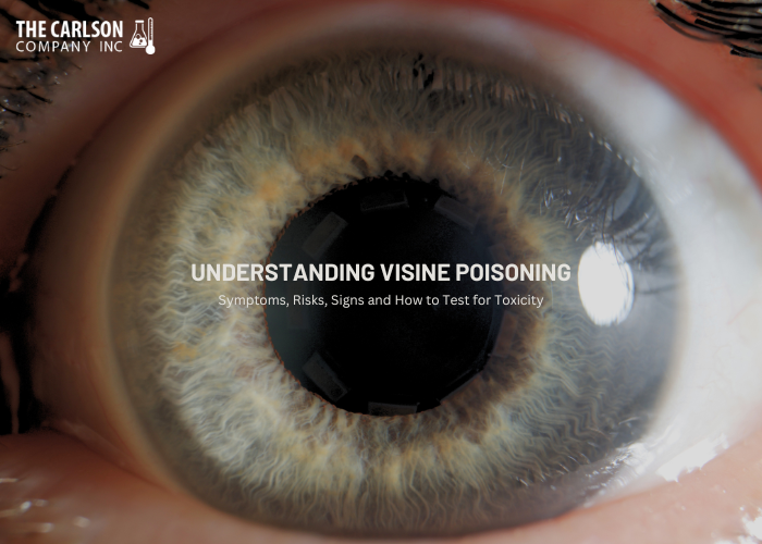 Visine Poisoning