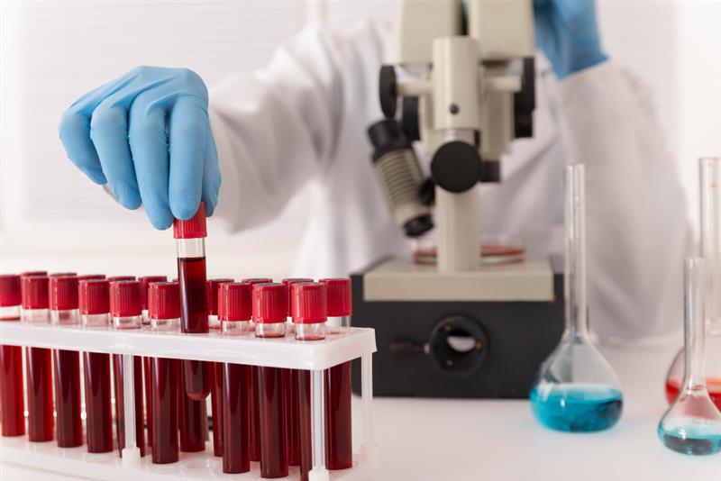 Chemical Poisons Testing in Blood - The Carlson Company